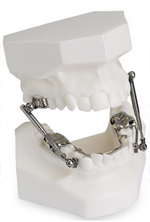 Swasty Orthodontics APPLIANCES